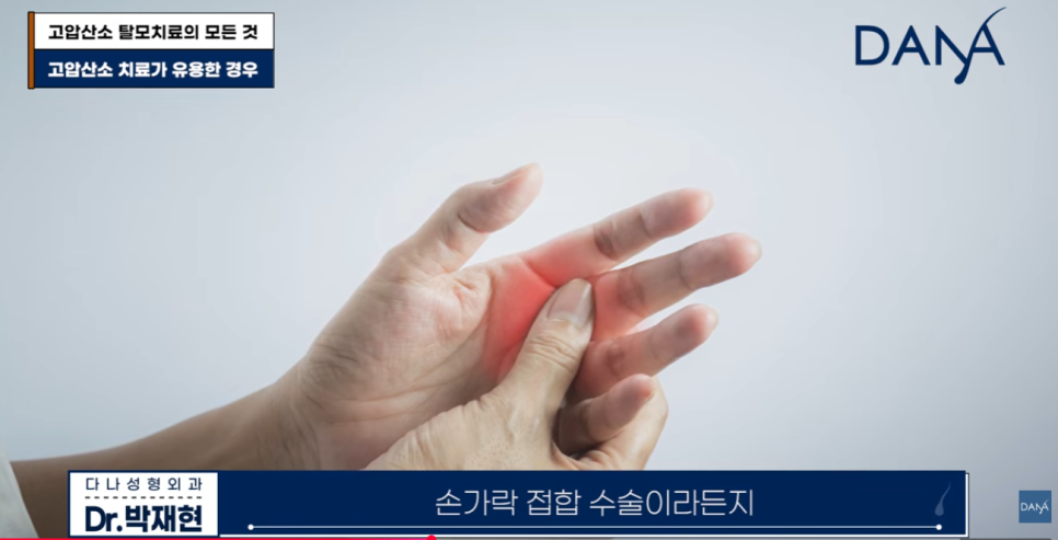고압산소 탈모치료 돈 낭비일까? 부작용부터 효과까지 총정리 관련 이미지 15