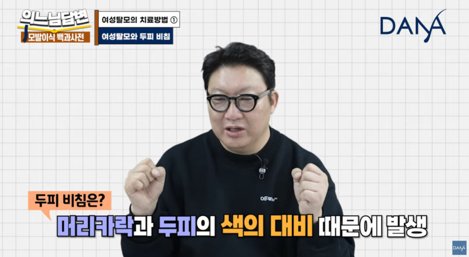 여성형 탈모, 두피문신vs모발이식? 관련 이미지 4