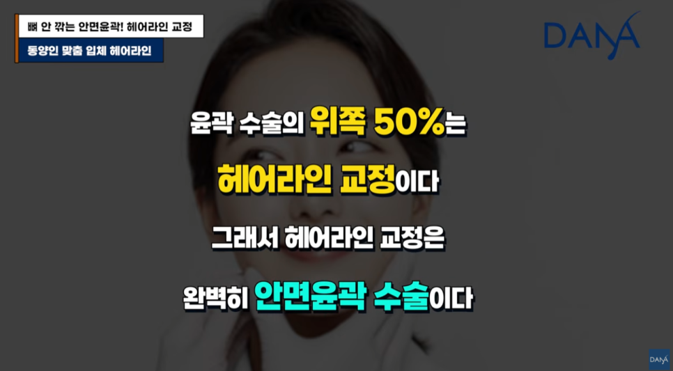 동양인vs서양인 이마 차이, 한국인에게 헤어라인 교정이 필수인 이유 관련 이미지 13