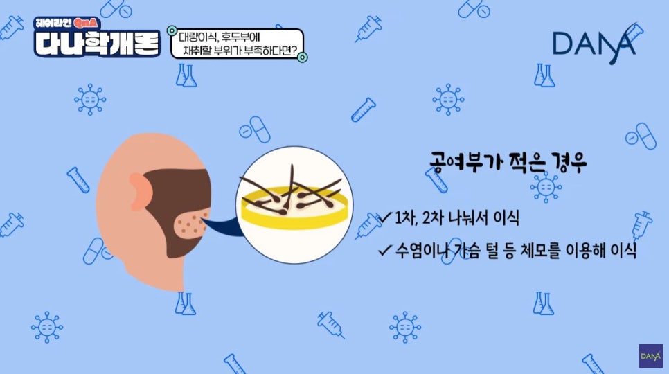 대량이식, 채취할 모발이 부족하면 어떻게 해야할까? 관련 이미지 4