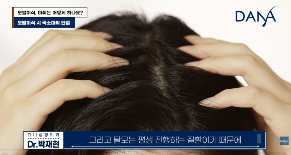 모발이식 마취 통증 걱정된다면? 국소마취 vs 수면마취 장단점 비교 선택 기준 관련 이미지 7