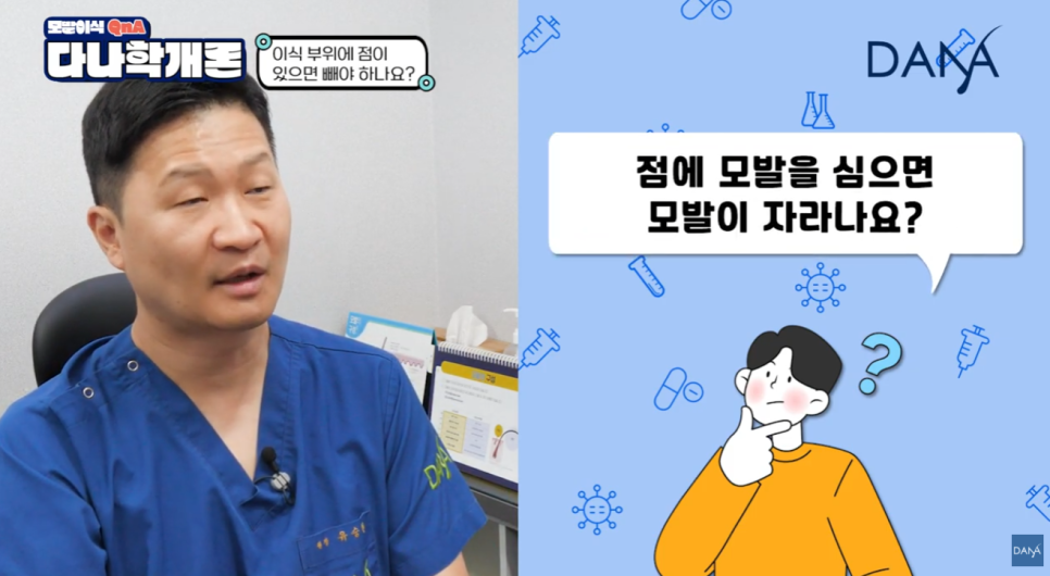 머리에 점이 있어도 모발이식 할 수 있나요? 관련 이미지 5