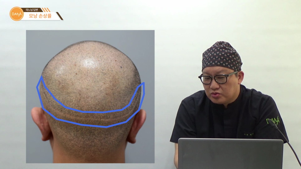 Factors That Affect Follicle Damage Rates During Hair Transplant Surgery image 2