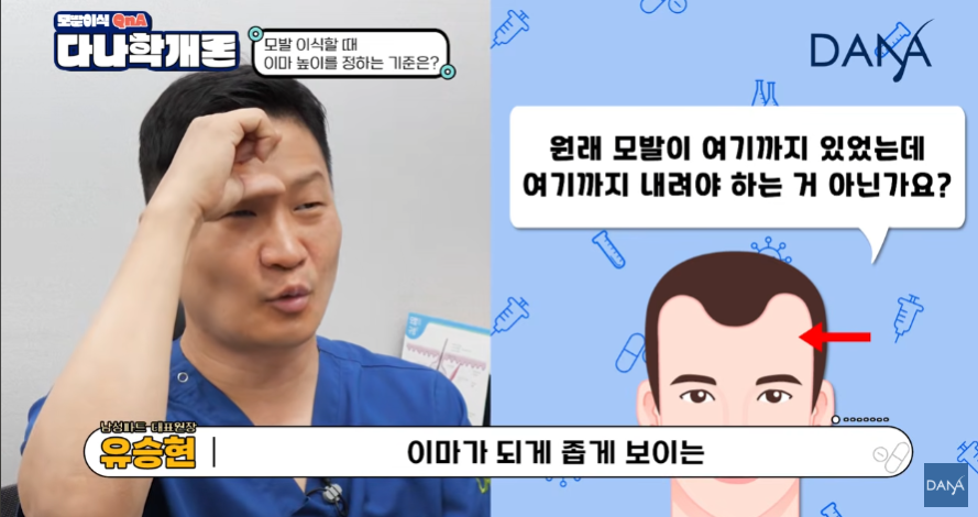 모발이식 이마 높이 정하는 기준! 무작정 낮추면 안되는 이유 관련 이미지 1