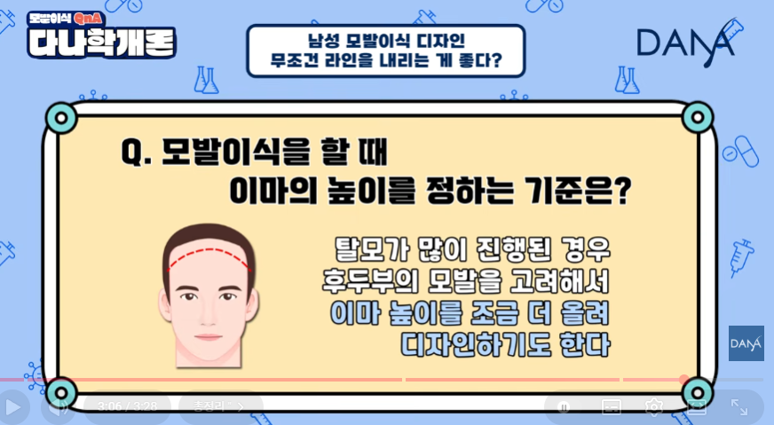 모발이식 이마 높이 정하는 기준! 무작정 낮추면 안되는 이유 관련 이미지 8