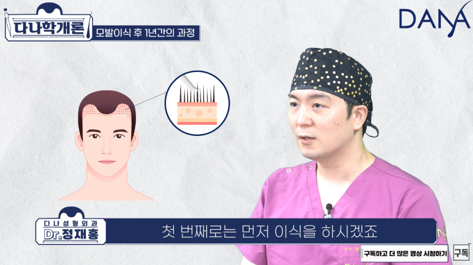 모발이식 1년후 (수술후 머리카락이 자라나는 과정) 관련 이미지 1