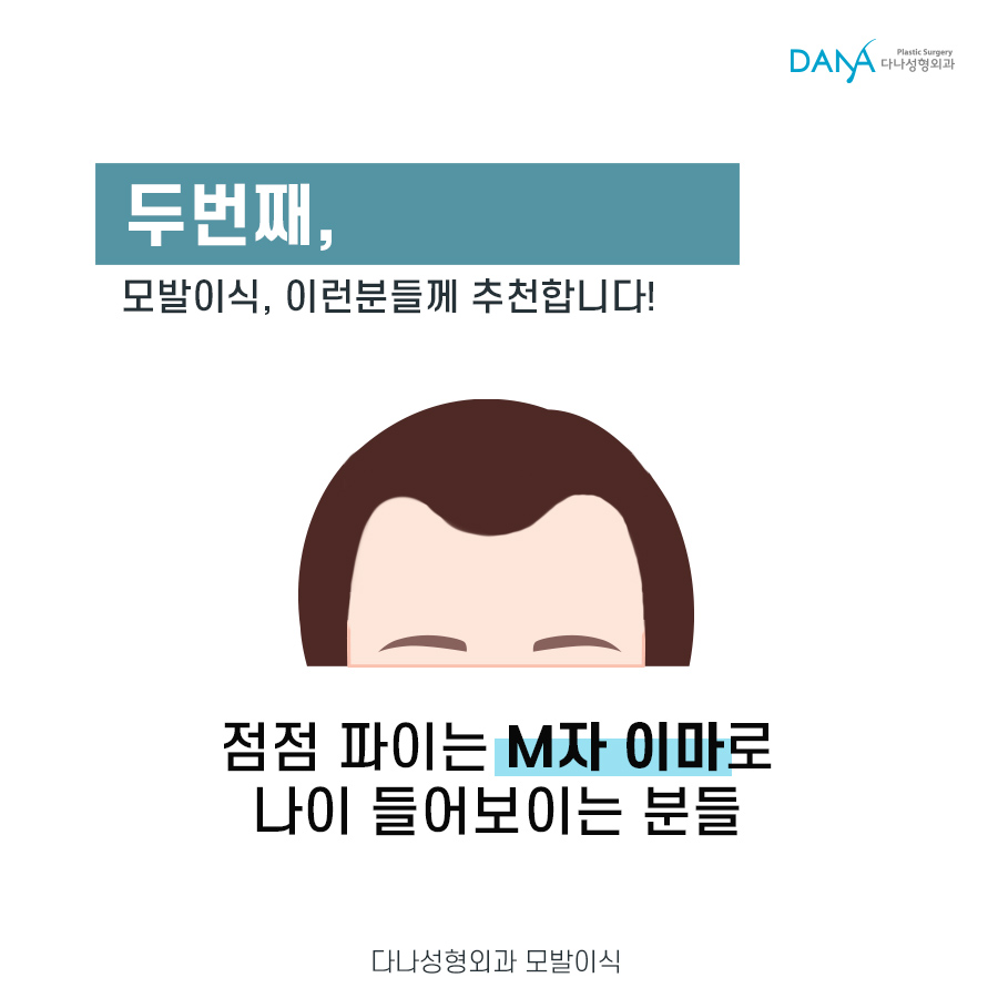 Male Hair Loss: Another Way to Overcome It Is Hair Transplantation image 4