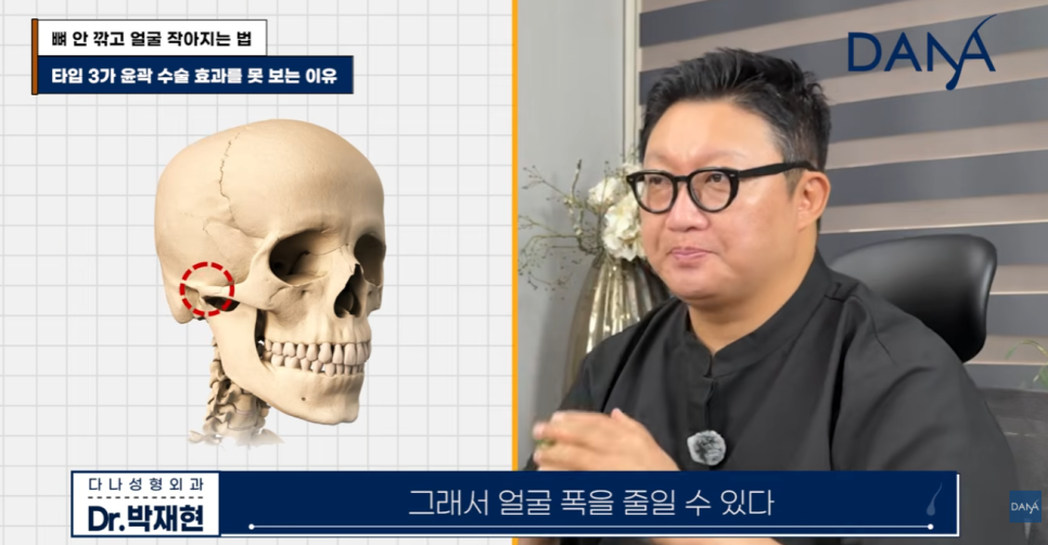 뼈 안 깎고 얼굴 작아지는 법? 광대 수술 효과 없는 관련 이미지 16