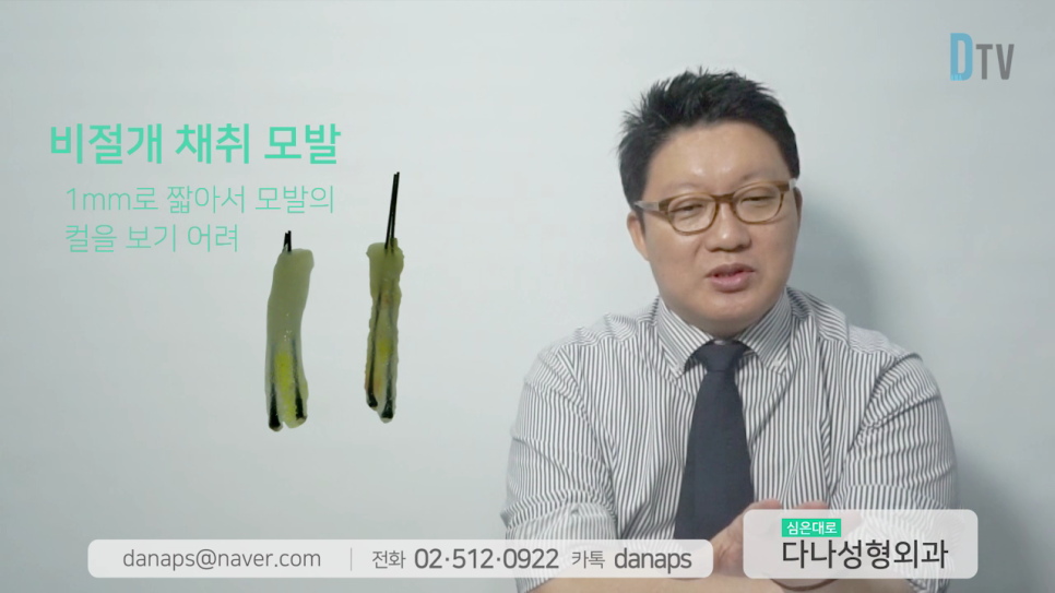 If You Want Natural Results, Long-Hair Non-Shaven Non-Incisional Hair Transplantation image 18