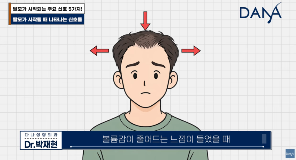 혹시 나도 탈모일까? 초기 증상 5가지와 10초 자가진단법 관련 이미지 7
