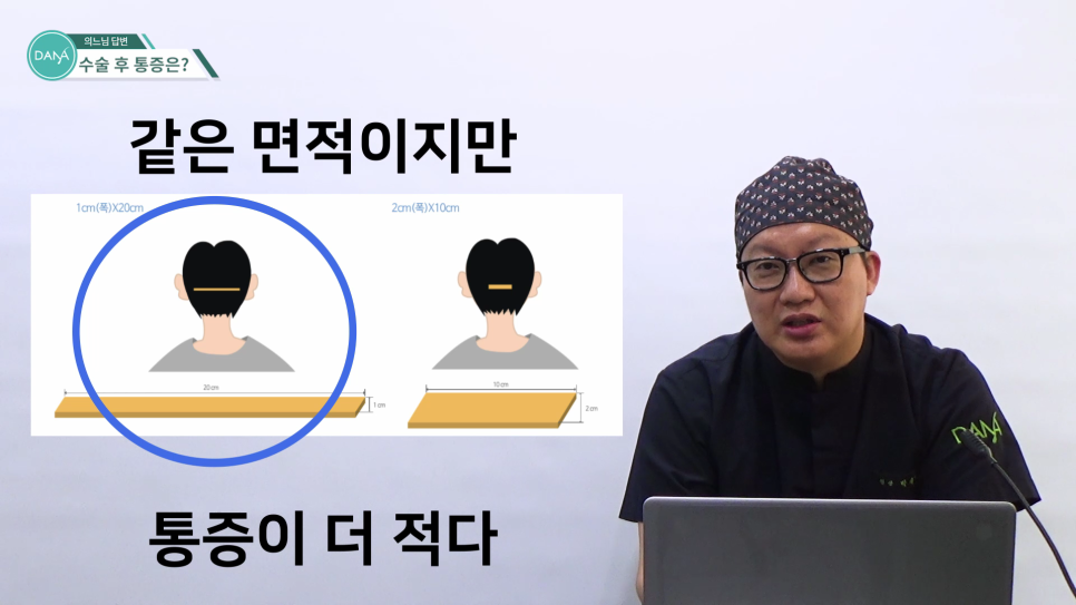 How to Reduce Pain After Hair Transplant Surgery image 7