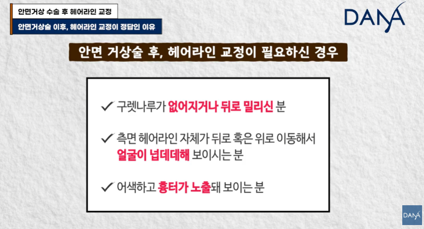 안면거상술 후 흉터와 헤어라인 변형, 자연스럽게 해결하는 방법 관련 이미지 22