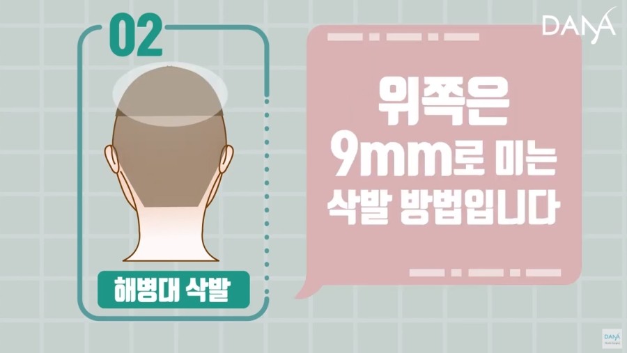비절개 모발이식 시 삭발방법 종류 관련 이미지 6
