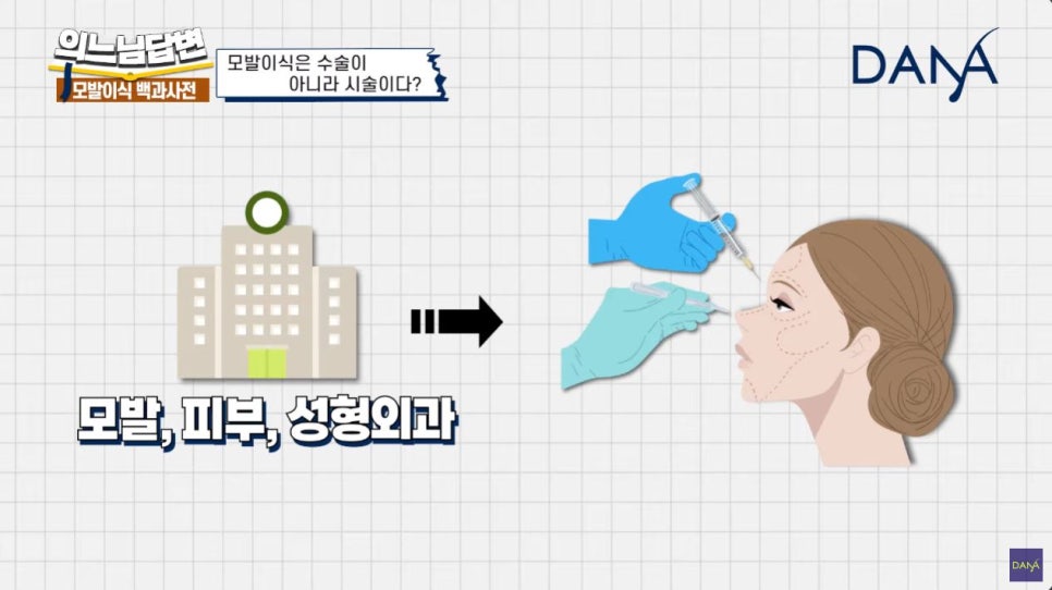 모발이식, 수술일까? 시술일까? 관련 이미지 5