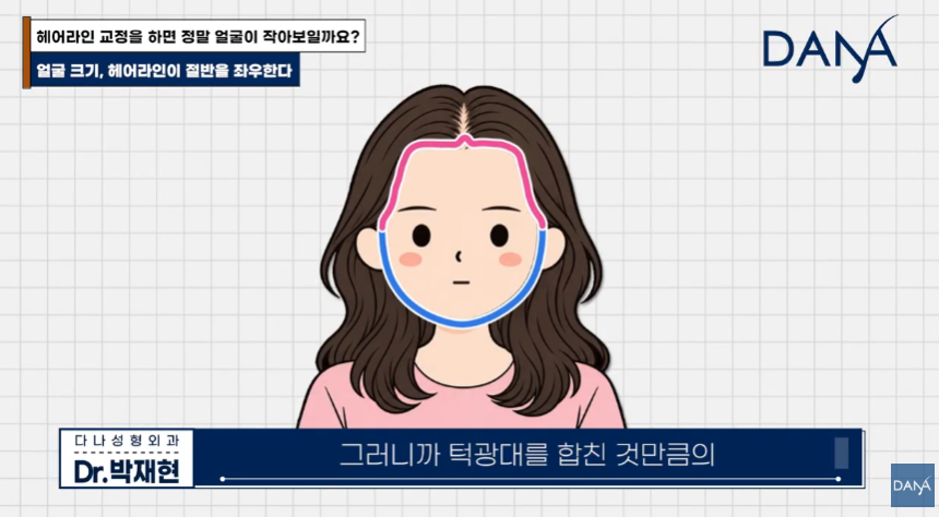 넙데데한 얼굴이 고민이라면? 상위 1% 원장님이 말하는 진짜 안면 축소술 관련 이미지 15