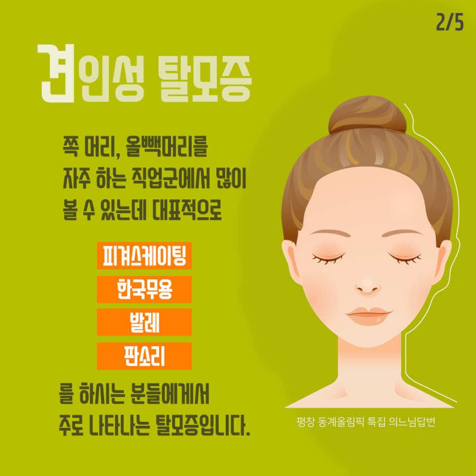 머리를 세게 묶어 오는 견인성 탈모 관련 이미지 3