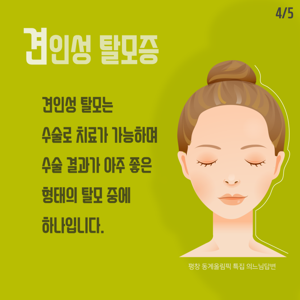 머리를 세게 묶어 오는 견인성 탈모 관련 이미지 5