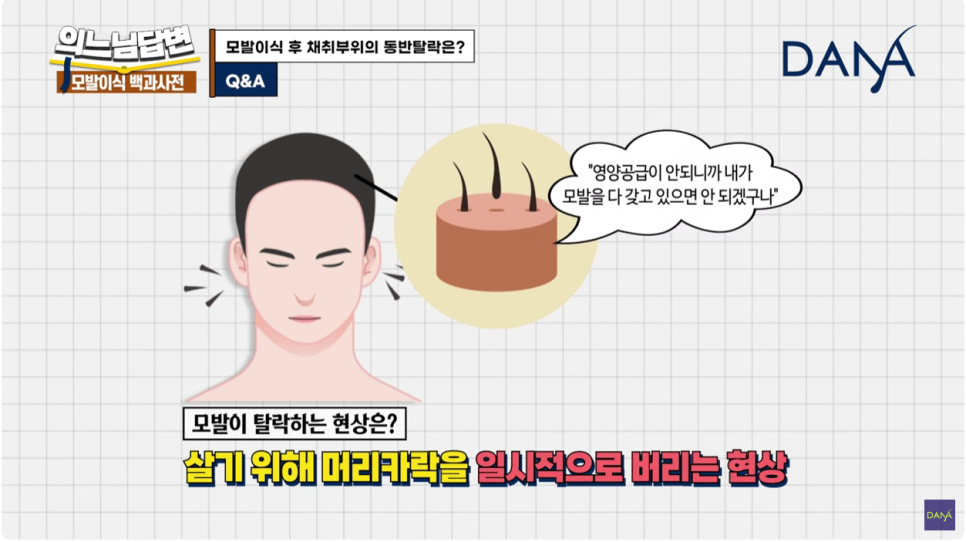 Hair Transplant Donor-Site Shedding That Can Occur After Hair Transplant Surgery image 12