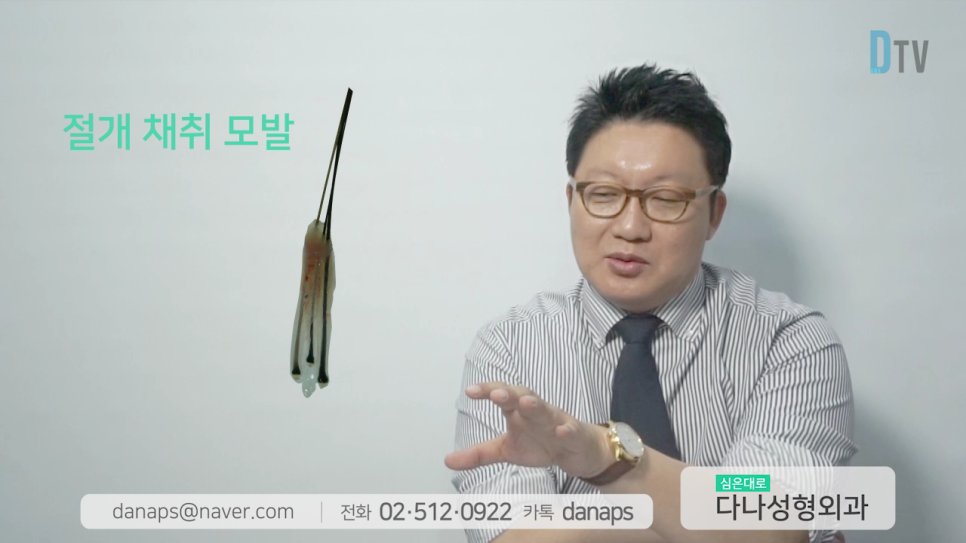 If You Want Natural Results, Long-Hair Non-Shaven Non-Incisional Hair Transplantation image 17