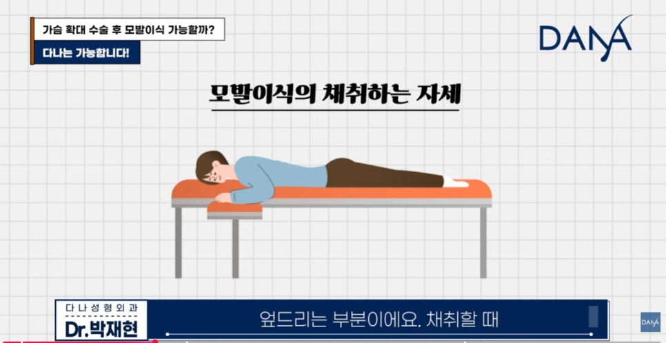 가슴 확대 수술 후 모발이식 가능할까? 관련 이미지 3