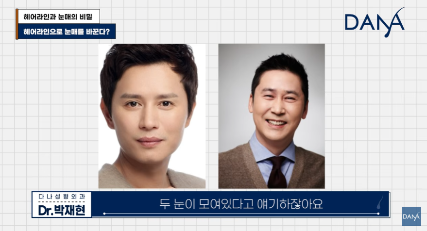 진짜 몰린 눈 VS 가짜 몰린 눈! 눈매가 답답해 보이는 진짜 이유 관련 이미지 3