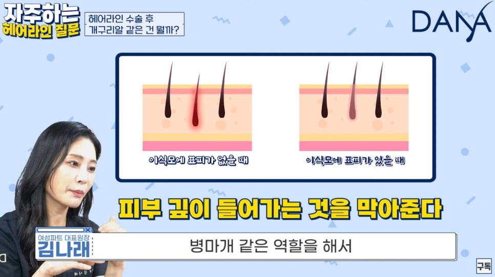 After Hairline Surgery, Are the Frog-Egg-Like Bumps a Side Effect? image 5