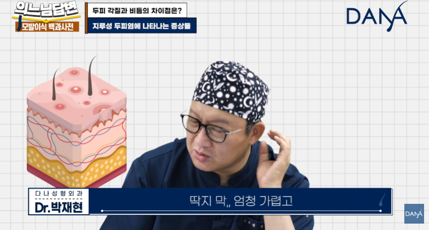 머리 잘 감아도 비듬 생기는 뜻밖의 원인! 두피 각질 차이 및 해결법 관련 이미지 12