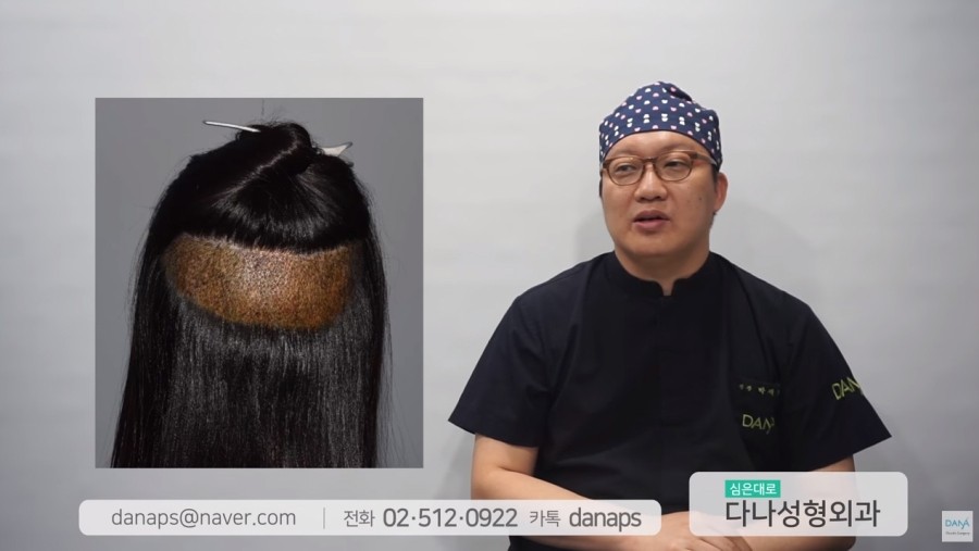 여성 헤어라인 교정에서 무삭발 비절개의 장단점 관련 이미지 2