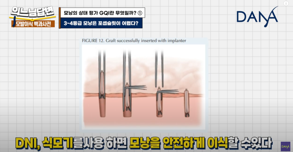 What Is GQI? ① image 16