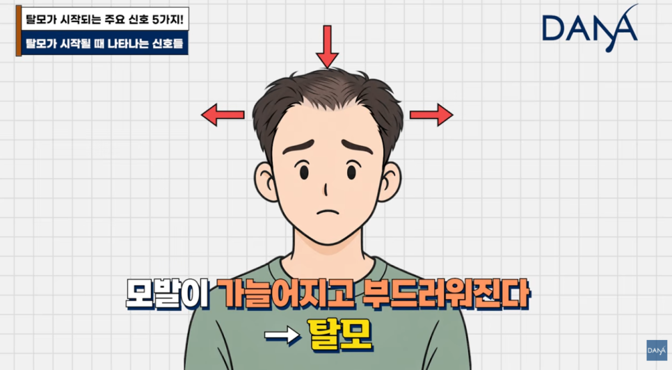 혹시 나도 탈모일까? 초기 증상 5가지와 10초 자가진단법 관련 이미지 8