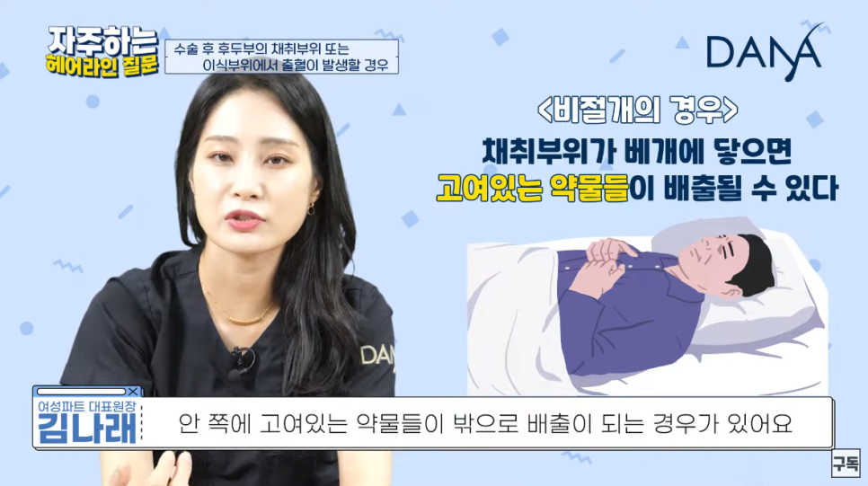모발이식 수술 후 이식부위에 피가 난다면? 관련 이미지 2