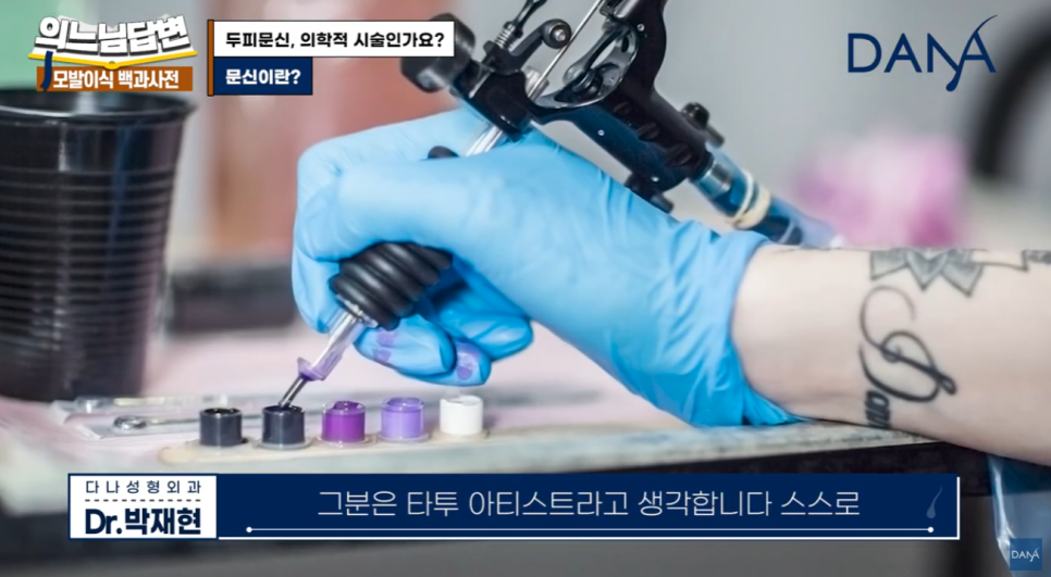 두피문신, 단순 타투일까 의학적 시술일까? 관련 이미지 5