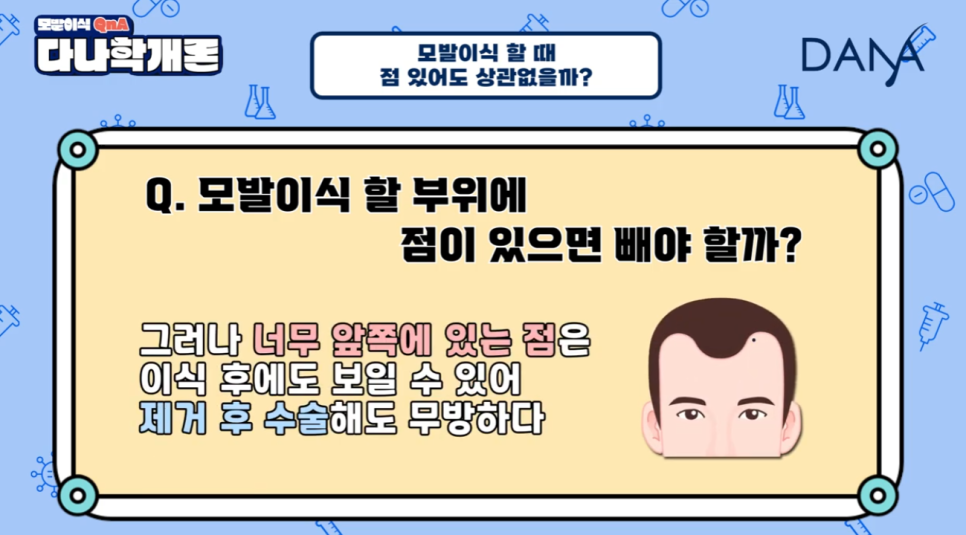 머리에 점이 있어도 모발이식 할 수 있나요? 관련 이미지 13