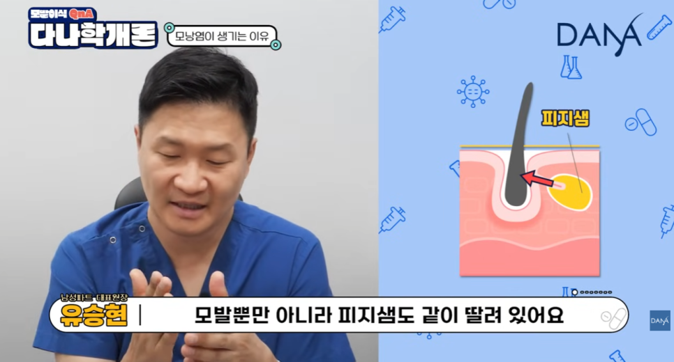 모발이식 후 모낭염, 수술 실패일까? 원인과 대처 꿀팁! 관련 이미지 4