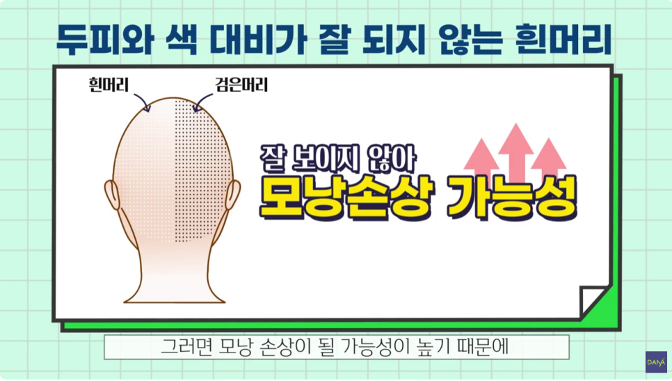 Checklist Before Hair Transplant Surgery! image 9