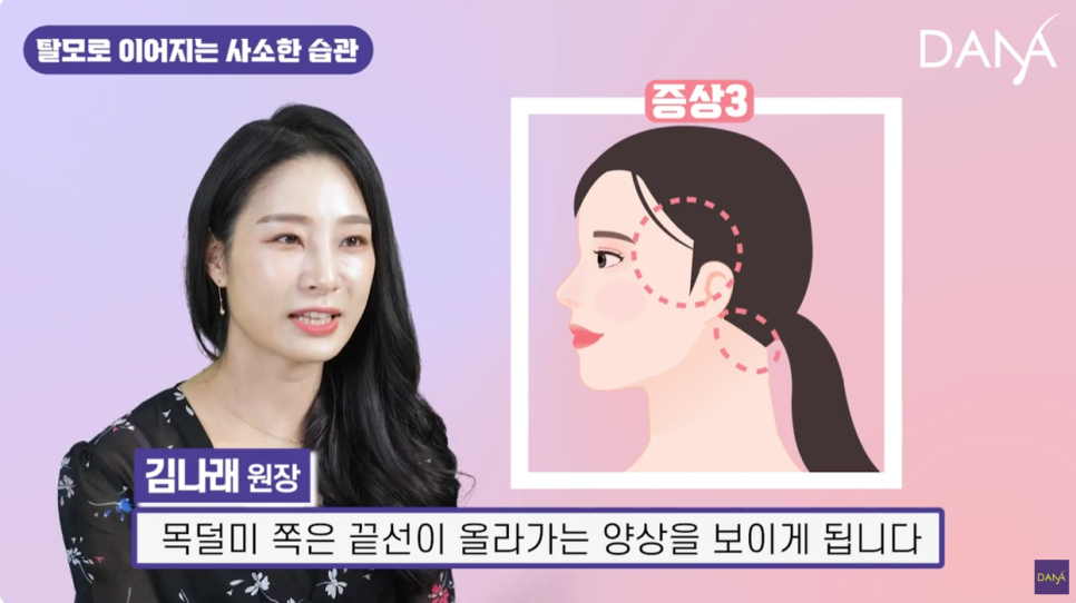 Habits That Cause Hair Loss, as Explained by a Doctor image 6