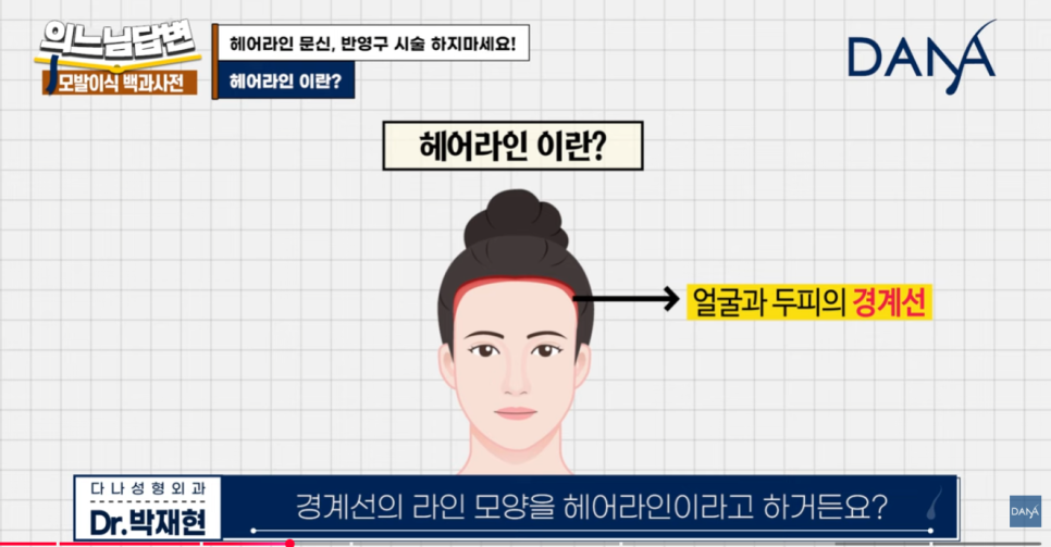 Why You Should Never Get a Hairline Scalp Tattoo image 2