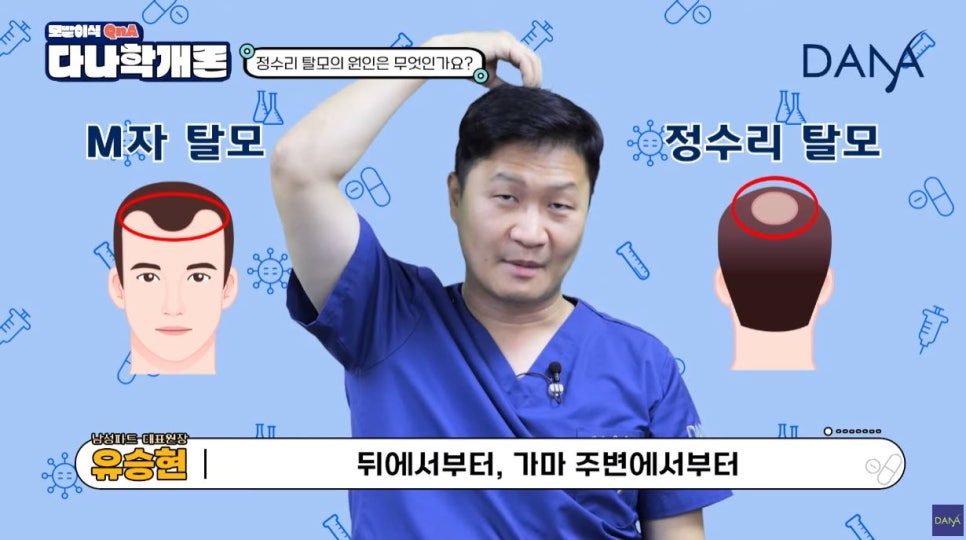남성 탈모, 이러면 정수리 탈모 의심해볼 수 있습니다! 관련 이미지 1