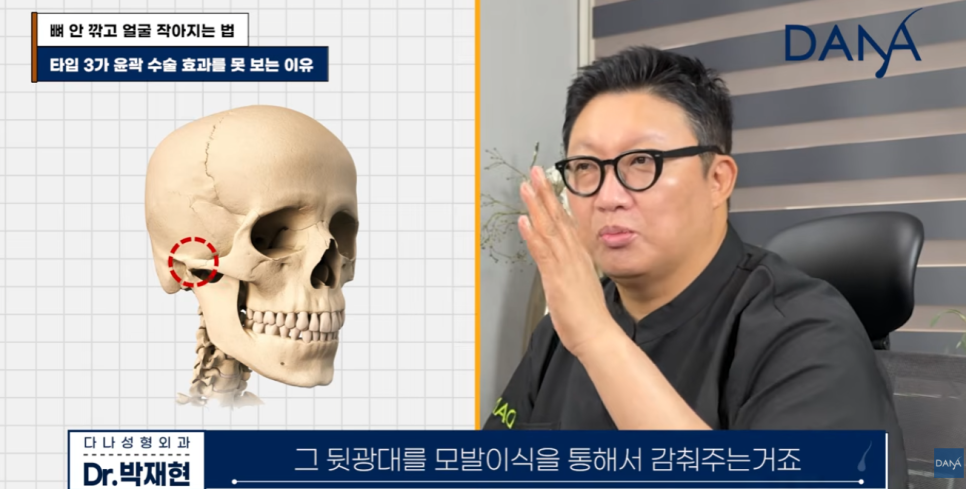 뼈 안 깎고 얼굴 작아지는 법? 광대 수술 효과 없는 관련 이미지 15