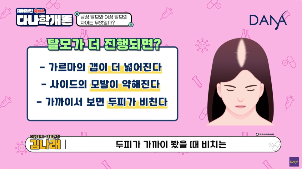 여성탈모원인 파악하고 제대로 치료하세요 관련 이미지 4