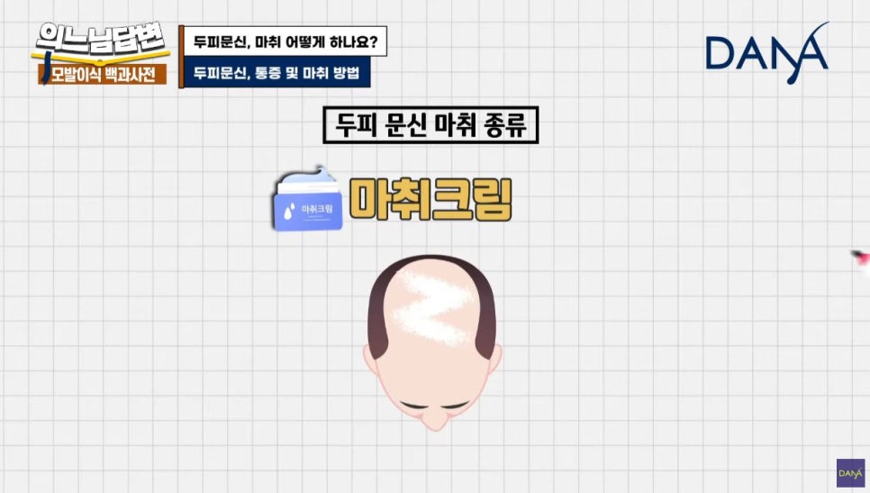 두피문신, 마취는 어떻게 하나요? 관련 이미지 5