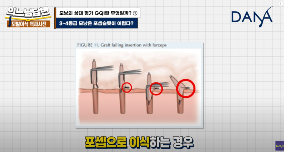 What Is GQI? ① image 15