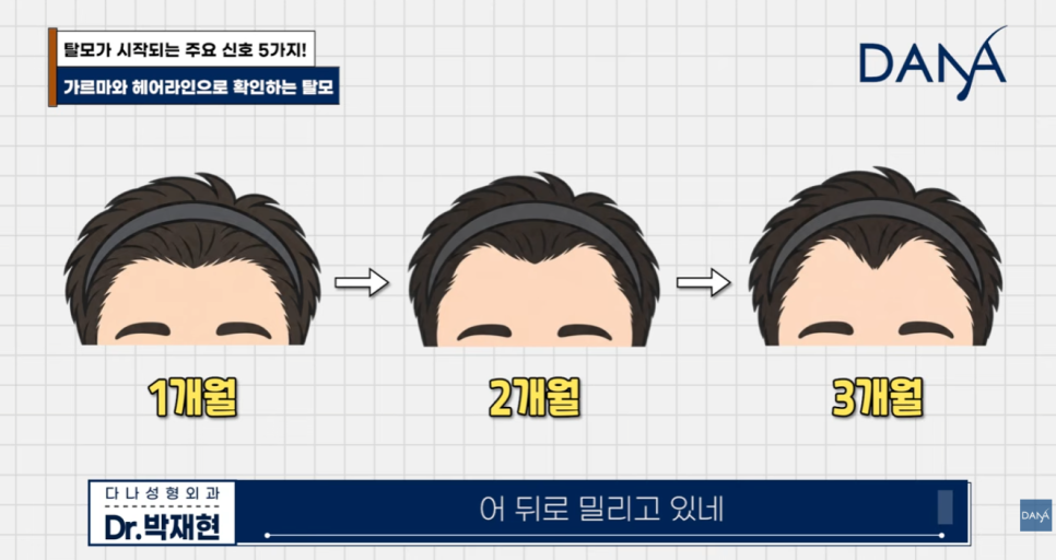 혹시 나도 탈모일까? 초기 증상 5가지와 10초 자가진단법 관련 이미지 24