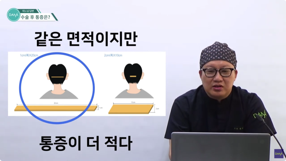 How to Reduce Pain After Hair Transplant Surgery image 5