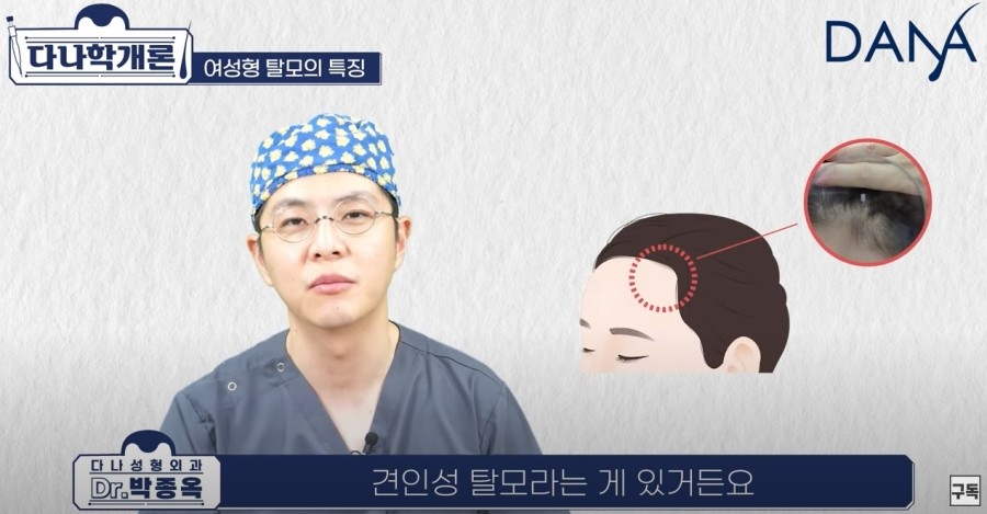 여성탈모,남성탈모와 차이점은 관련 이미지 11