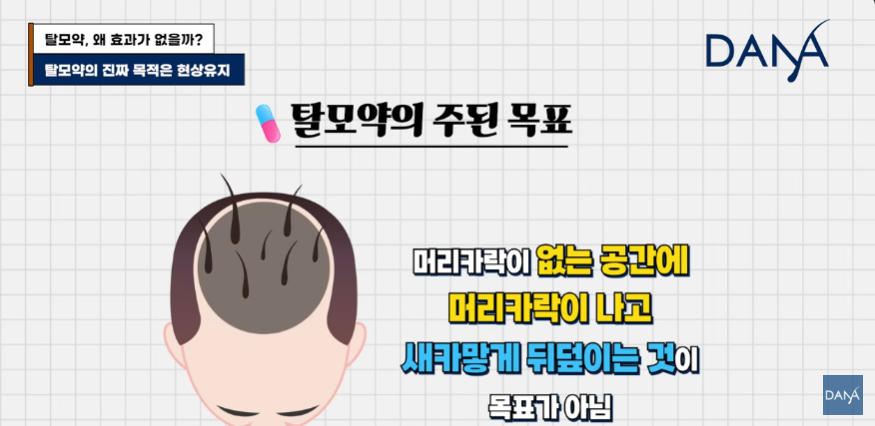 한두 달 먹고 효과 없다고 탈모약 끊은 분들 100% 후회합니다 관련 이미지 2