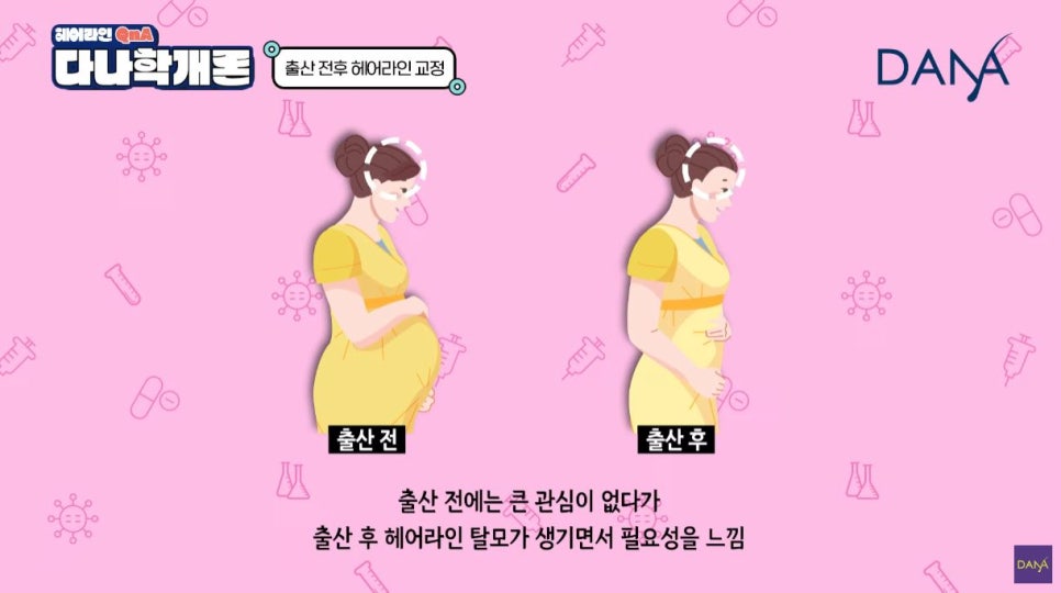 산후탈모 출산 후 생기는 이유와 헤어라인교정 시기는? 관련 이미지 3