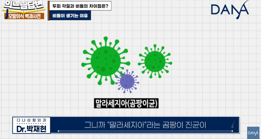 머리 잘 감아도 비듬 생기는 뜻밖의 원인! 두피 각질 차이 및 해결법 관련 이미지 6