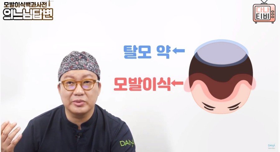 정수리모발이식수술 성공률을 높이는 방법은? 관련 이미지 6