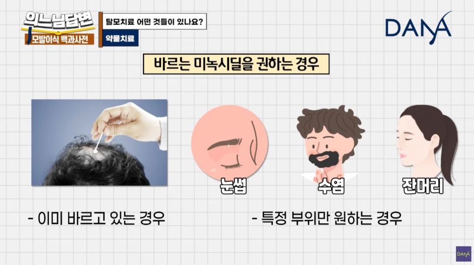 Hair Loss Medication? Botox Treatment? Types of Hair Loss Treatment _ Part 1 image 6